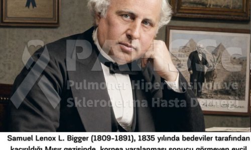 Akciğer Naklinin Tarihçesi -2.6- S. L. L. Bigger - Hayvanda Kornea Nakli - 2025.03.11