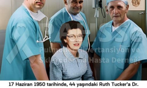 Akciğer Naklinin Tarihçesi -3.1- Lawler, Kadaverik Donörden Böbrek Nakli Denemesi - 2025.01.10