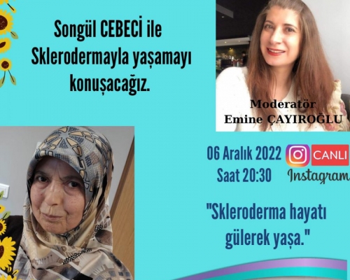 Hasta Hikayeleri - Songül CEBECİ ile Sklerodermayla Yaşamak - 71 - 2022.12.06