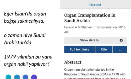 Eğer İslam'da organ bağışı sakıncalıysa,  o zaman niye Suudi Arabistan'da 1979 yılından bu yana organ nakli yapılıyor - 2022.10.31