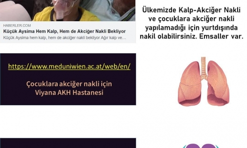 Organ Naklinde Yurt dışı Seçeneği - 2019.09.02