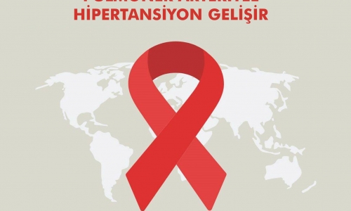 Dünya Aids Günü - 2019.12.01