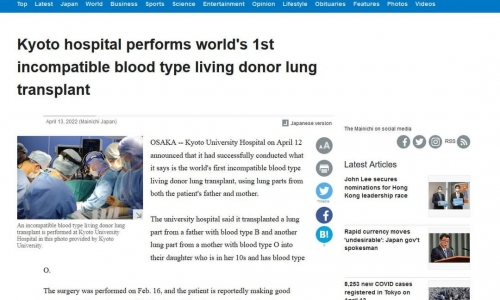 Kyoto Hastanesi dünyada ilk kez kan uyumu olmayan canlı donörden Akciğer Nakli yaptı - 2022.04.13