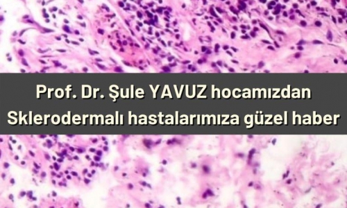 Prof. Dr. Şule YAVUZ hocamızdan Sklerodermalı hastalarımıza güzel haber - 2021.03.05