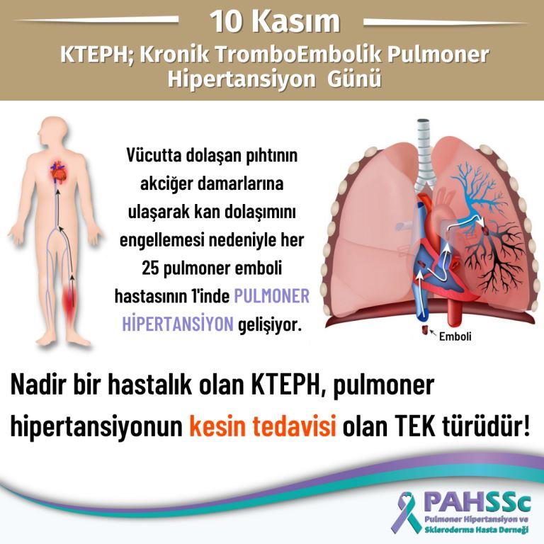 pulmoner komplikasyonlarla birlikte yüksek tansiyon